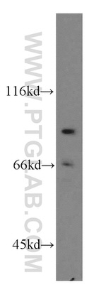 RRM1 Antibody in Western Blot (WB)