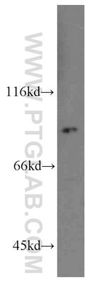 RRM1 Antibody in Western Blot (WB)