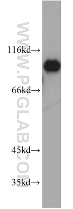 EIF2C1 Antibody in Western Blot (WB)