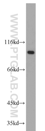 EIF2C1 Antibody in Western Blot (WB)