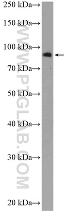 EIF2C3 Antibody in Western Blot (WB)