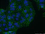 Integrin beta-6 Antibody in Immunocytochemistry (ICC/IF)