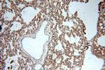 Integrin beta-6 Antibody in Immunohistochemistry (Paraffin) (IHC (P))