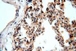 Integrin beta-6 Antibody in Immunohistochemistry (Paraffin) (IHC (P))