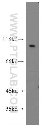 Integrin beta-6 Antibody in Western Blot (WB)