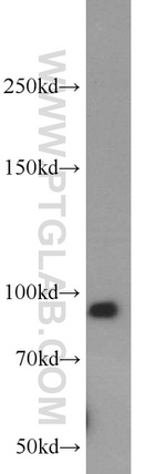Integrin beta-6 Antibody in Western Blot (WB)