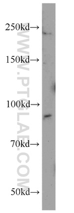 Integrin beta-6 Antibody in Western Blot (WB)