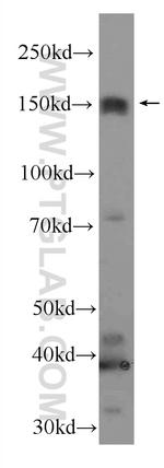 Jagged 2 Antibody in Western Blot (WB)