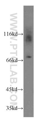 Kv1.4 Antibody in Western Blot (WB)