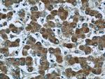 ND1 Antibody in Immunohistochemistry (Paraffin) (IHC (P))