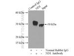ND1 Antibody in Immunoprecipitation (IP)