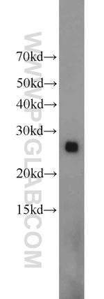 ND1 Antibody in Western Blot (WB)