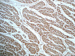 ND1 Antibody in Immunohistochemistry (Paraffin) (IHC (P))