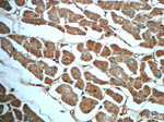 ND1 Antibody in Immunohistochemistry (Paraffin) (IHC (P))
