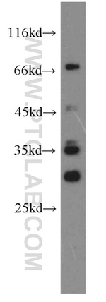 ND1 Antibody in Western Blot (WB)