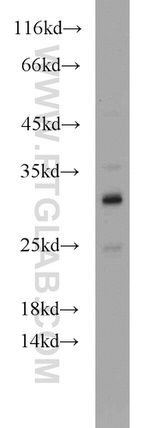 ND1 Antibody in Western Blot (WB)