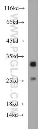ND1 Antibody in Western Blot (WB)