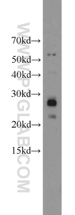 ND1 Antibody in Western Blot (WB)