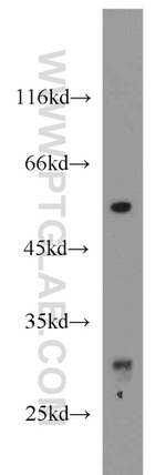 ND1 Antibody in Western Blot (WB)