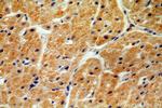 ND2 Antibody in Immunohistochemistry (Paraffin) (IHC (P))