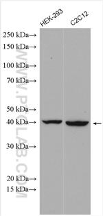 ND2 Antibody in Western Blot (WB)