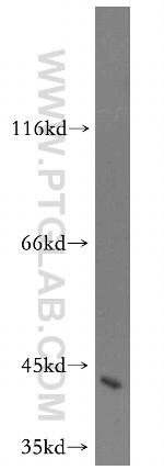 ND2 Antibody in Western Blot (WB)