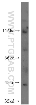 ND2 Antibody in Western Blot (WB)