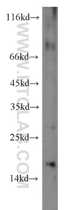 persephin Antibody in Western Blot (WB)