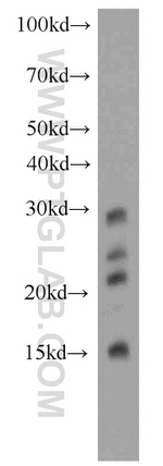 PTPRCAP / CD45AP Antibody in Western Blot (WB)