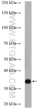 PTPRCAP / CD45AP Antibody in Western Blot (WB)