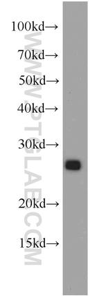 PTPRCAP / CD45AP Antibody in Western Blot (WB)