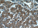PYGM Antibody in Immunohistochemistry (Paraffin) (IHC (P))