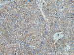 SPTBN1 Antibody in Immunohistochemistry (Paraffin) (IHC (P))