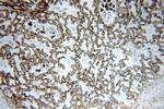 SPTBN1 Antibody in Immunohistochemistry (Paraffin) (IHC (P))