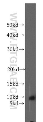 STATH Antibody in Western Blot (WB)