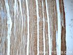 TNNT3 Antibody in Immunohistochemistry (Paraffin) (IHC (P))