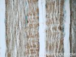 TNNT3 Antibody in Immunohistochemistry (Paraffin) (IHC (P))