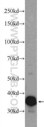TNNT3 Antibody in Western Blot (WB)