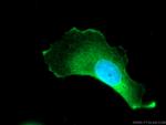 SYNGAP1 Antibody in Immunocytochemistry (ICC/IF)