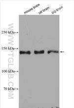 SYNGAP1 Antibody in Western Blot (WB)