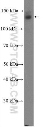 SYNGAP1 Antibody in Western Blot (WB)