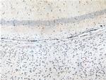 SYNGAP1 Antibody in Immunohistochemistry (Paraffin) (IHC (P))