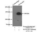 SYNGAP1 Antibody in Immunoprecipitation (IP)