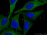 KALRN Antibody in Immunocytochemistry (ICC/IF)
