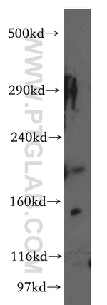 KALRN Antibody in Western Blot (WB)