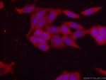 KALRN Antibody in Immunocytochemistry (ICC/IF)