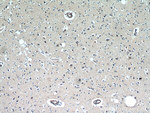 RAB11B Antibody in Immunohistochemistry (Paraffin) (IHC (P))