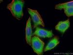 SLK Antibody in Immunocytochemistry (ICC/IF)