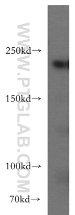 SLK Antibody in Western Blot (WB)