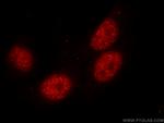 THRAP3 Antibody in Immunocytochemistry (ICC/IF)